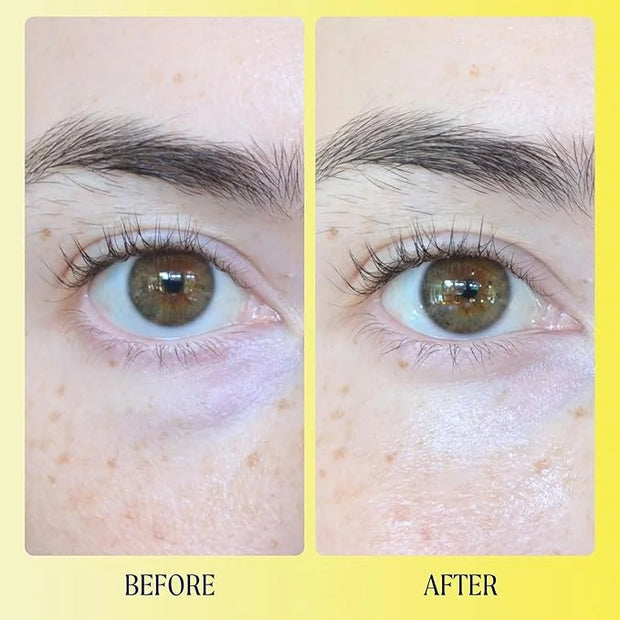 Kinship Brightwave Vitamin C Energizing + Brightening Eye Cream - Reduce Dark Circles & Puffiness - Diminishes Fine Lines ...