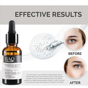 Persephone Eye Serum Oil | Sacha Inchi Oil, Bisabolol and Vitamin C & E | Eye Serum for Wrinkles, Finelines and Dark Circl...