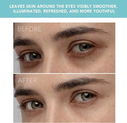 FOREO IRIS Eye Massager Dark Circle Remover & Eyebag Remover Eye Depuffer Anti Aging Increases Absorption of Eye Mask Esse...