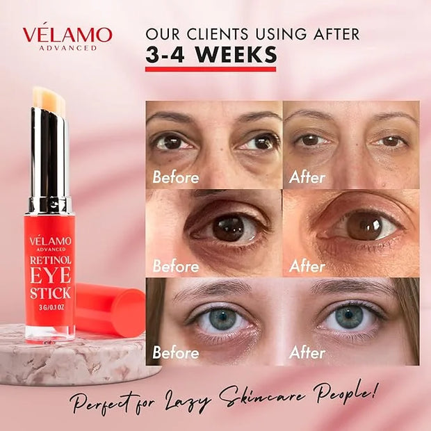 VELAMO ADVANCED Retinol Eye Stick: Retinol Under Eye Cream for Dark Circles and Puffiness with 1% Bakuchiol - Anti Aging B...