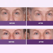 INSTA-TOX Facial Firming Wrinkle Smoothing Serum & Reverse Lift Firming Eye Cream Set - Tightener for Lines, Deep Wrinkles...