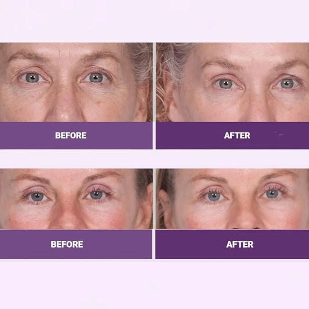 INSTA-TOX Facial Firming Wrinkle Smoothing Serum & Reverse Lift Firming Eye Cream Set - Tightener for Lines, Deep Wrinkles...