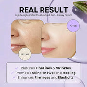 Excuse My Frank Age Defense Bakuchiol Korean Serum, Natural Retinol, Dark Spot Serum, Anti aging, Fine Lines & Wrinkle Car...