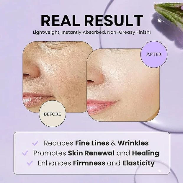 Excuse My Frank Age Defense Bakuchiol Korean Serum, Natural Retinol, Dark Spot Serum, Anti aging, Fine Lines & Wrinkle Car...