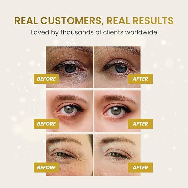 PLANTIFIQUE Gold Eye Patches for Puffy Eyes and Dark Circles 5 Pairs Under Eye Masks for Dark Circles and Puffiness Eye Ge...