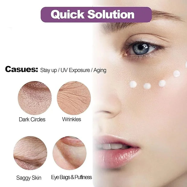 Xylane Eye Cream for Dark Circle & Puffiness, Caffeine/Pro-Xilane Active Anti-Wrinkle Eye Cream, Anti-Aging Active Eye Rep...