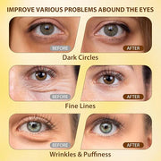 Soulight 5% Caffeine Eye Serum for Anti Aging | Reduce Dark Circles, Puffiness, Fine Lines & Wrinkles | Hyaluronic Acid & ...
