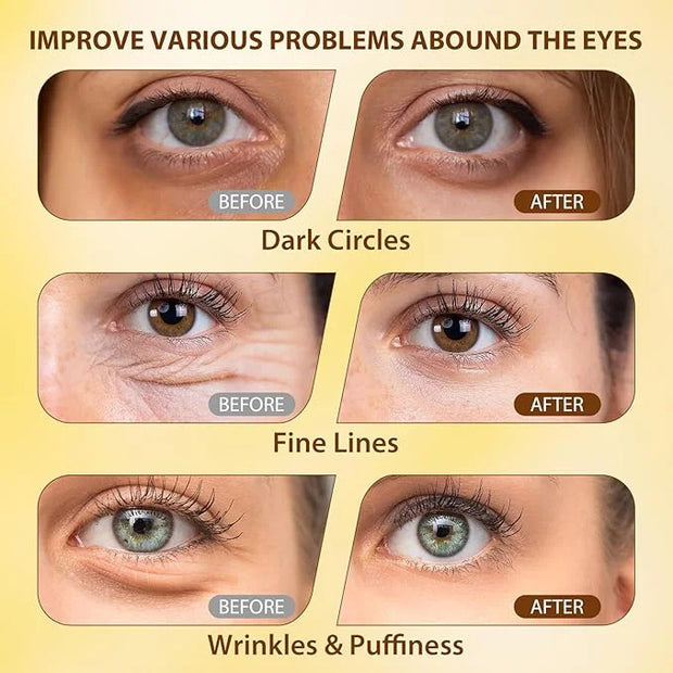 Soulight 5% Caffeine Eye Serum for Anti Aging | Reduce Dark Circles, Puffiness, Fine Lines & Wrinkles | Hyaluronic Acid & ...