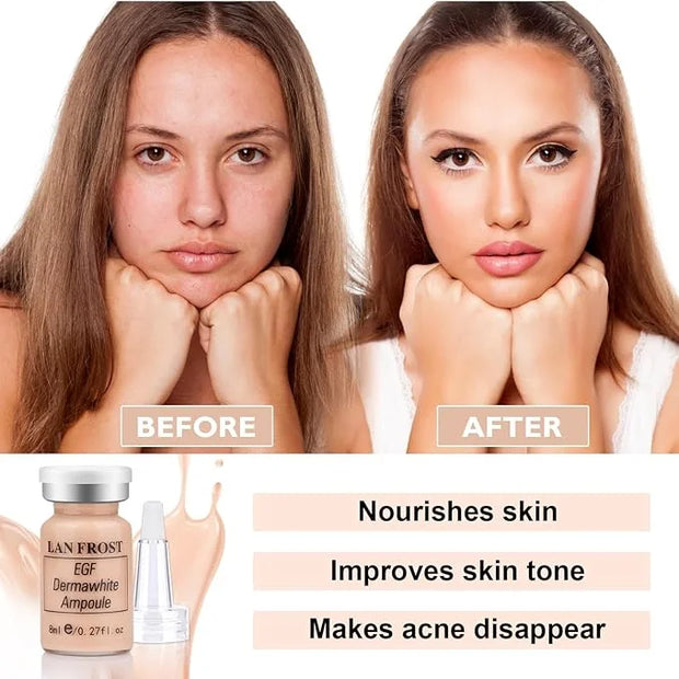 BB Facial Glow Serum Starter Kit Hyaluronic Acid Essence Foundation Skin Care Kit 0.27oz 12 Vials, Combined With Niacinami...