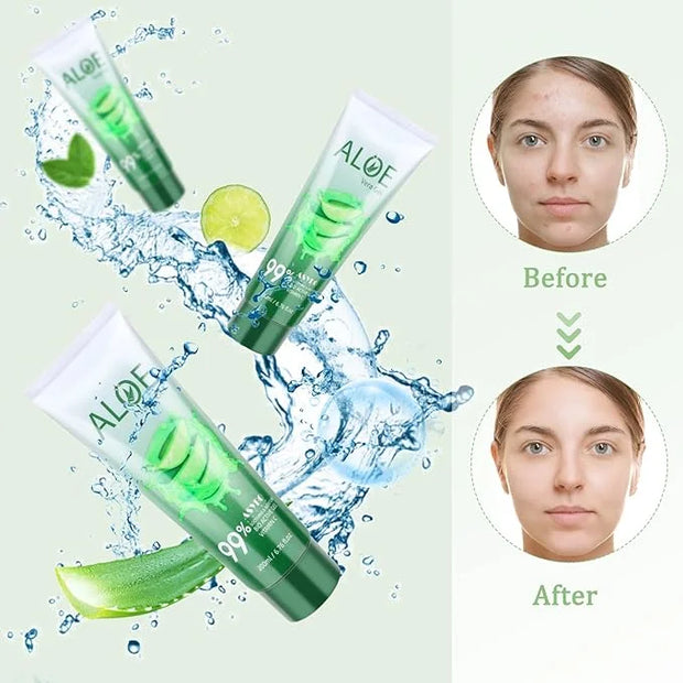 200x2 ML Aloe Vera Gel – 99% Organic Pure Aloe Vera Hydrating Face & Body Moisturizer, Natural Aloe Cream for Dry Skin, Su...