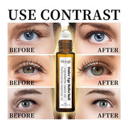 Eye Roller for Puffy Eyes, Castor Oil and Frankincense Eye Roller for Dark Circles, and Wrinkles, Anti Aging Eye Serum Cre...