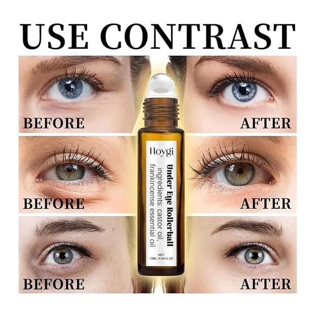 Eye Roller for Puffy Eyes, Castor Oil and Frankincense Eye Roller for Dark Circles, and Wrinkles, Anti Aging Eye Serum Cre...