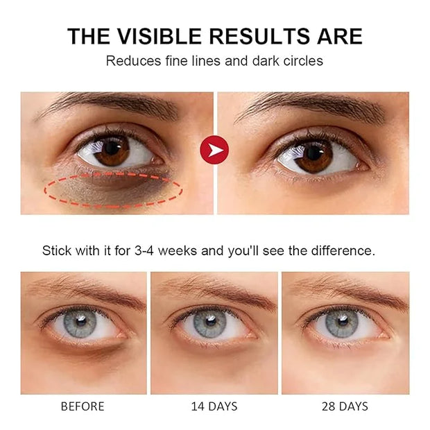 Retinol Eye Stick with Collagen,Hyaluronic Acid for Dark Circle, Wrinkles,Eye Balm Moisturizes Anti Aging,Visible Results ...