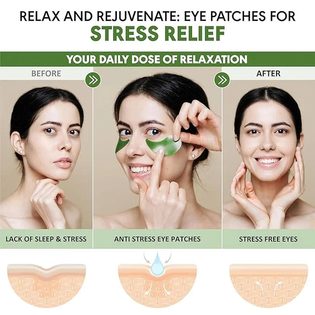 Eye Masks for Dark Circles and Puffiness – Hydrating Eye Patches with Collagen Hyaluronic Acid Green Tea & Aloe - Under Ey...