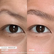 DRMTLGY Dark Circles Bundle - Medium: Luminous Eye Corrector SPF 41 & HPR Eye Cream - Product Image