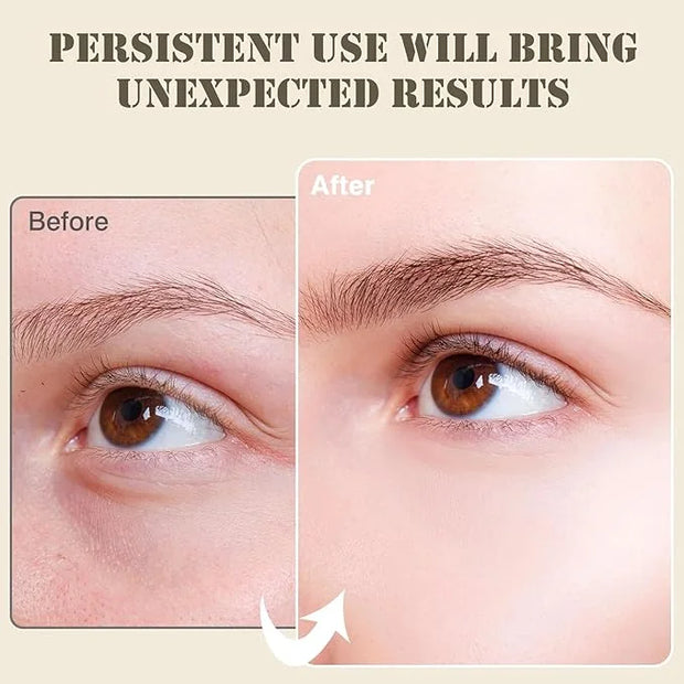 60PCS Under Eye Patches for Women,Under Eyes Masks for Dark Circles and Puffiness, 24K Gold Eyes Bags Treatment, Anti-Wrin...