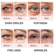 Caffeine Eye Cream,Dark Circles Under Eye Treatment For Puffiness And Bags Under Eyes Wrinkles Dark Circles w/Eye Serum & ...