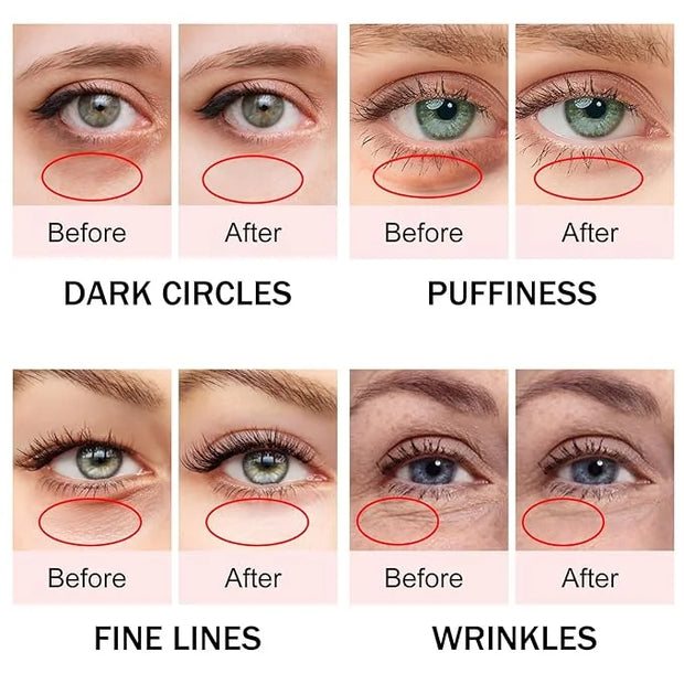 Caffeine Eye Cream,Dark Circles Under Eye Treatment For Puffiness And Bags Under Eyes Wrinkles Dark Circles w/Eye Serum & ...