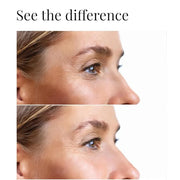 Dark circles under eye treatment | Eye Cream Anti Aging. Formulated for Dark Circles, Bags under the Eyes and Reducing Wri...