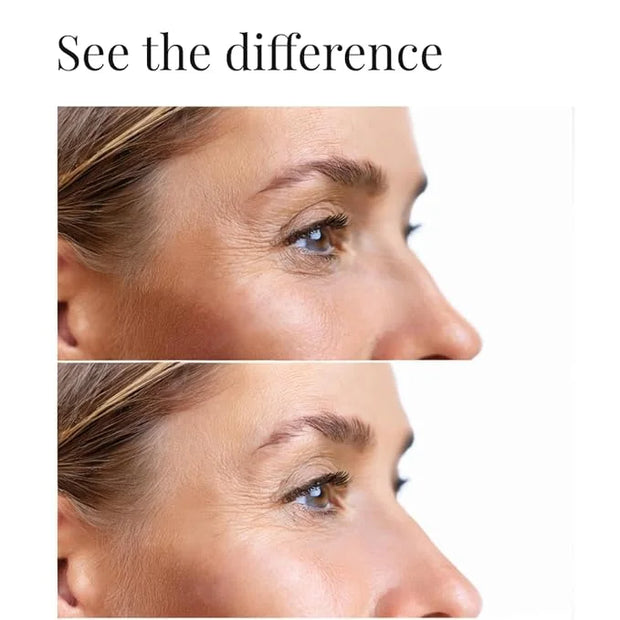 Dark circles under eye treatment | Eye Cream Anti Aging. Formulated for Dark Circles, Bags under the Eyes and Reducing Wri...