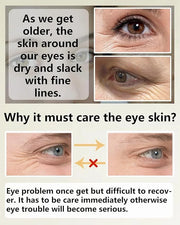 Under Eye Patches (60Pcs) - Upgraded Eye Mask Retinol & Collagen, Eye Treatment Mask, Under Eye Bag Treatment, Eye Masks f...