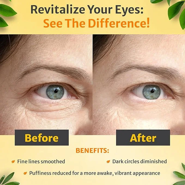 True Love Under Eye Cream for Wrinkles – Eye Cream for Puffiness and Bags under Eyes – Non-Greasy, Long-Lasting Comfort fo...