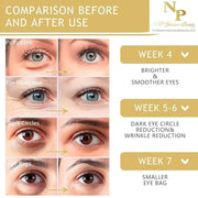 Anti-Wrinkles Eye Cream - Fast Absorbing, Natural Ingredients for Dark Circles, Puffy Eyes, and Wrinkle Reduction, 30 gram...