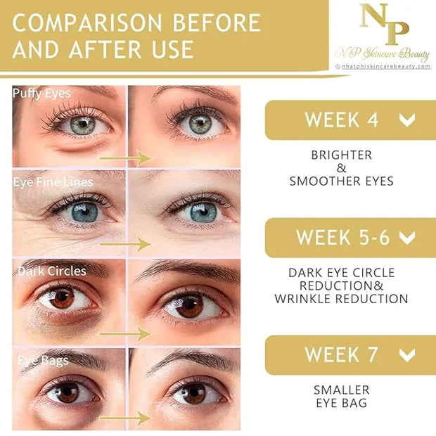 Anti-Wrinkles Eye Cream - Fast Absorbing, Natural Ingredients for Dark Circles, Puffy Eyes, and Wrinkle Reduction, 30 gram...
