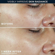 RoC Multi Correxion Revive + Glow Vitamin C Broad Spectrum SPF 30 Moisturizer (1.7 oz) with Retinol Eye Cream Packette - P...