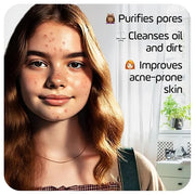 Asepxia Deep Cleansing Acne Treatment Bar Soap with Baking Soda and 2% Salicylic Acid, 4 Ounce - Product Image