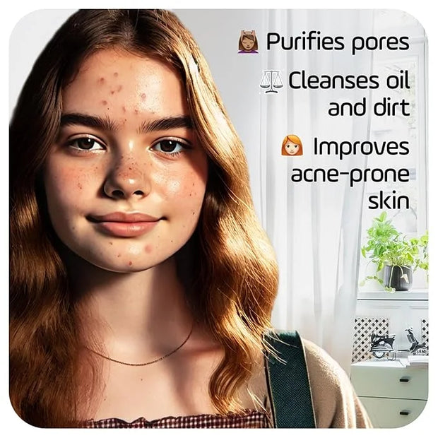 Asepxia Deep Cleansing Acne Treatment Bar Soap with Baking Soda and 2% Salicylic Acid, 4 Ounce - Product Image