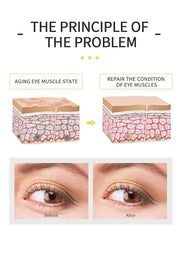 Banana Bright Eye Cream, Anti Aging Eye Cream with Squalane Dark Circle Under Eye Cream for Puffiness & Bags Moisturizing ...
