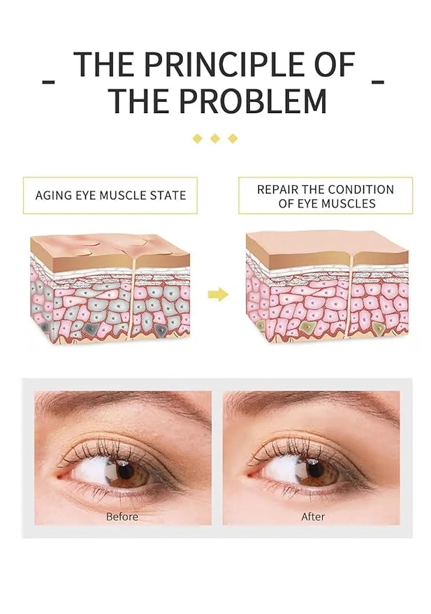 Banana Bright Eye Cream, Anti Aging Eye Cream with Squalane Dark Circle Under Eye Cream for Puffiness & Bags Moisturizing ...