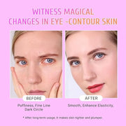 Under Eye Patches Gold and Hyaluronic Acid for puffy eyes,Rose Eye Masks for Dark Circles and Puffiness skin care Smooth W...