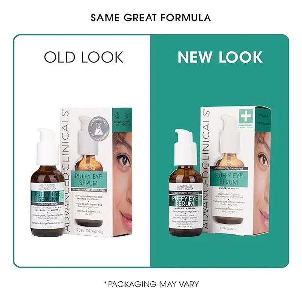 Advanced Clinicals Puffy Eye Under Eye Serum | Visible Anti Aging Brightening Vitamin C + Caffeine Serum Helps Improve Loo...