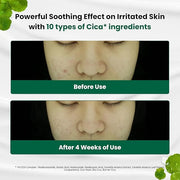 Dr.G Red Blemish Clear Soothing Korean Moisturizer Face Cream, 70ml - Cica Cream, Korean Skin Care Moisturizer, Korean Fac...