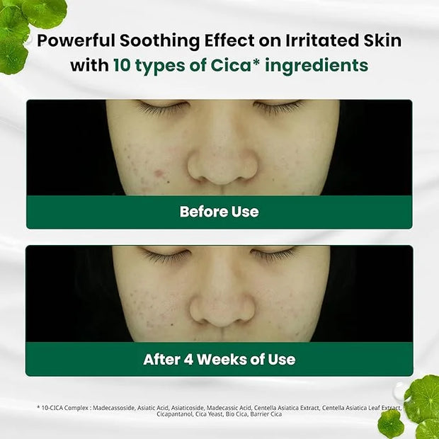 Dr.G Red Blemish Clear Soothing Korean Moisturizer Face Cream, 70ml - Cica Cream, Korean Skin Care Moisturizer, Korean Fac...