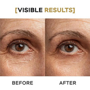 Moisturizing Eye Cream w/Aloe Vera, Collagen, Hyaluronic Acid, Cotton Stem Cells for Dark Circles, Puffiness & Bags - Unde...