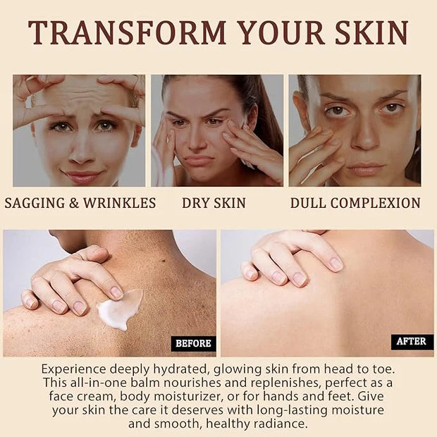 Organic Beef Tallow for Skin, Tallow Face Moisturizer, Tallow and Honey Balm, Grass-Fed Whipped Beef Tallow and Honey Crea...