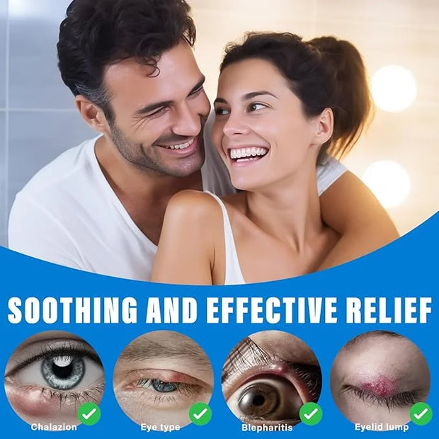 Stye Eye Treatment, Natural Stye Eye Relief Serum, for Styes Chalazion and Blepharitis Treatment, Restored Healthier Eye S...