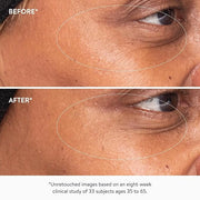 goop Beauty 3x Retinol Eye Lift Serum | Fine Lines and Wrinkles Treatment | 0.5 fl oz - Product Image