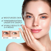 Retinol Under Eye Stick Balm: Cooling Eye Cream for Dark Circles Fine Lines Puffiness, Anti Wrinkle Hydrating Face Skincar...