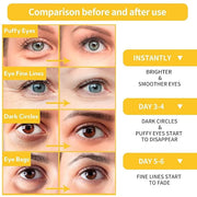 BREYLEE Under Eye Patches (30 Pairs), 24K Gold Eye Masks for Reducing Wrinkles and Fine Lines Under eye, Puffy Eyes and Da...