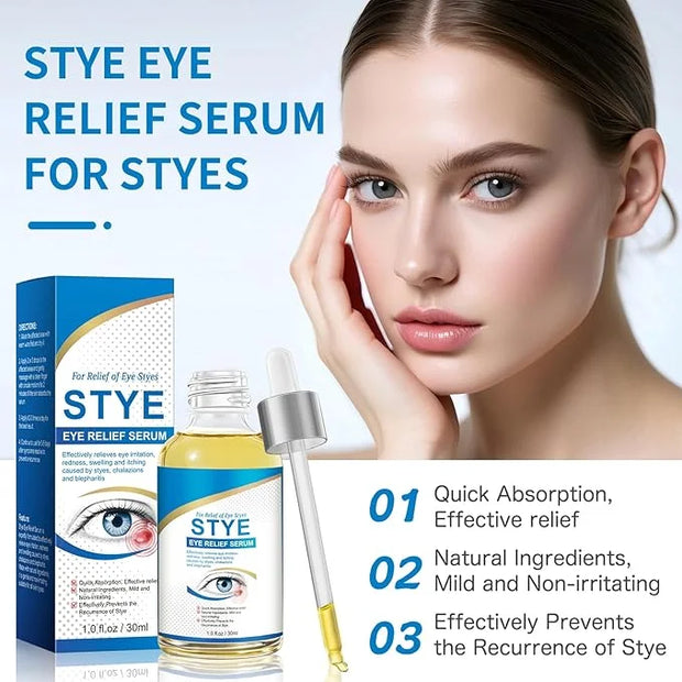 Stye Eye Treatment, Natural Stye Relief Serum for Styes, Chalazions and Blepharitis, Quickly Relieves Eye Irritation and R...