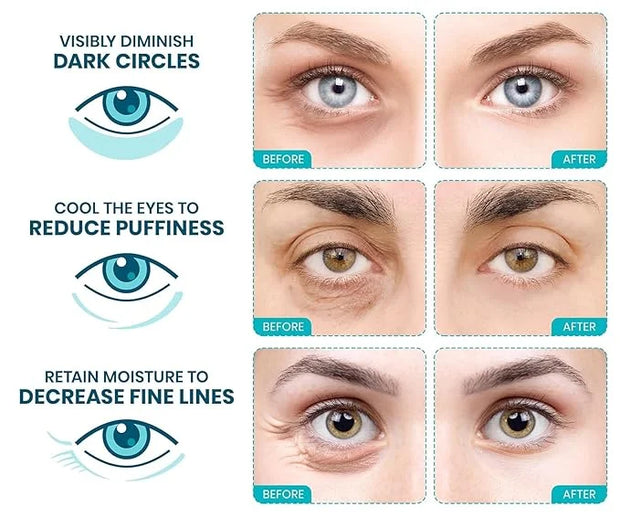 Stylia Under Eye Patches for Puffy Eyes and Dark Circles (30 Pairs) - Marine Collagen Under Eye Mask with Vitamin C, Hyalu...
