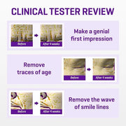 SOME BY MI Retinol Intense Reactivating Serum 50ml + Retinol Intense Advanced Triple Action Eye Cream - Product Image
