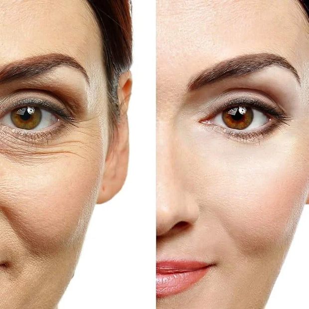Eye Gel, for Dark Circles, Puffiness, Wrinkles, Skin Firming and Bags - Effective Anti-Aging Eye Gel for Under and Around ...