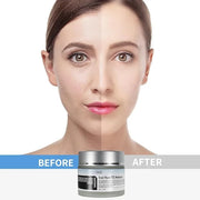 VGO Snail Mucin 92% Moisturizer 1.76 Fl Oz + Eye Cream for Dark Circles and Puffiness 0.5 Fl Oz - Product Image