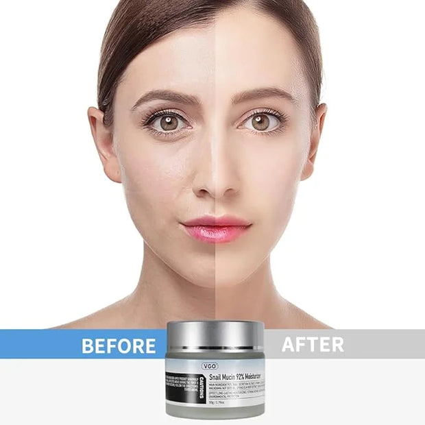 VGO Snail Mucin 92% Moisturizer 1.76 Fl Oz + Eye Cream for Dark Circles and Puffiness 0.5 Fl Oz - Product Image
