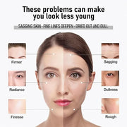 Face Tightener – Firms & Smooths the Look of Fine Lines & Wrinkles – Daily Moisturizer for Women & Men – 100ml (3.4 fl.oz)...